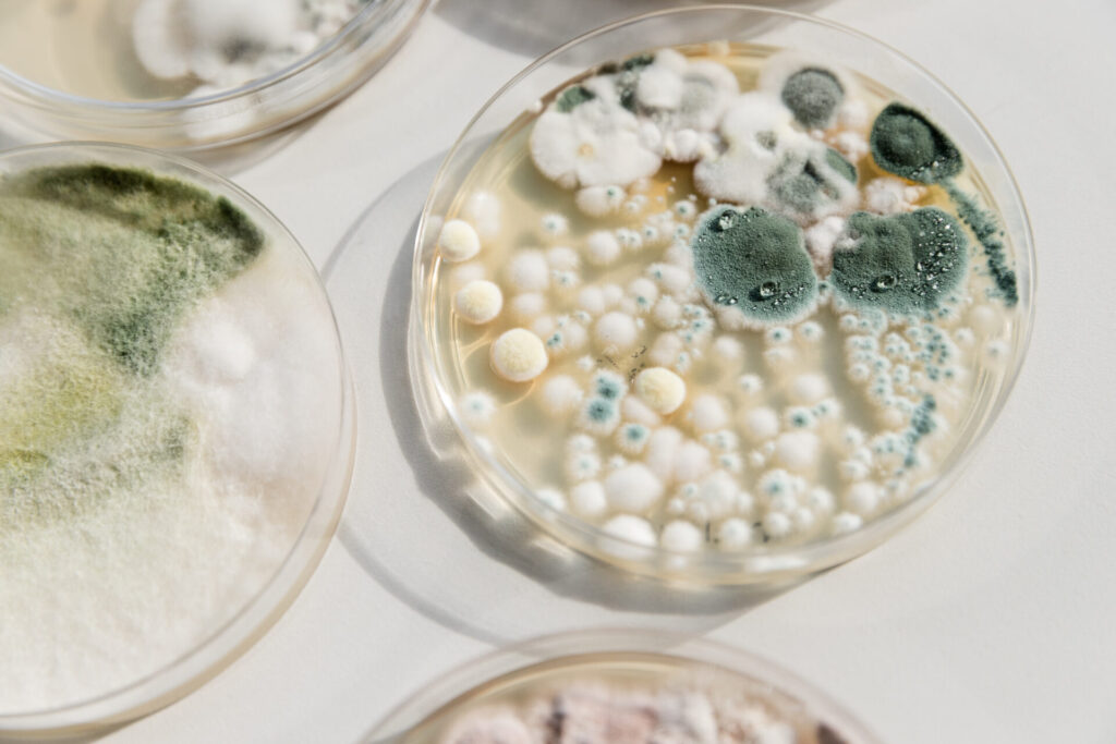 Environmental fungi growing on a petri dish › 스타일리쉬 플레이스 페트리 접시 위에 자생하는 다양한 곰팡이의 미세한 구조. 여러 색상의 곰팡이가 자생하는 모습이 돋보이는 이미지로, 곰팡이의 생태적 역할을 탐구하는 데 중요한 자료입니다.