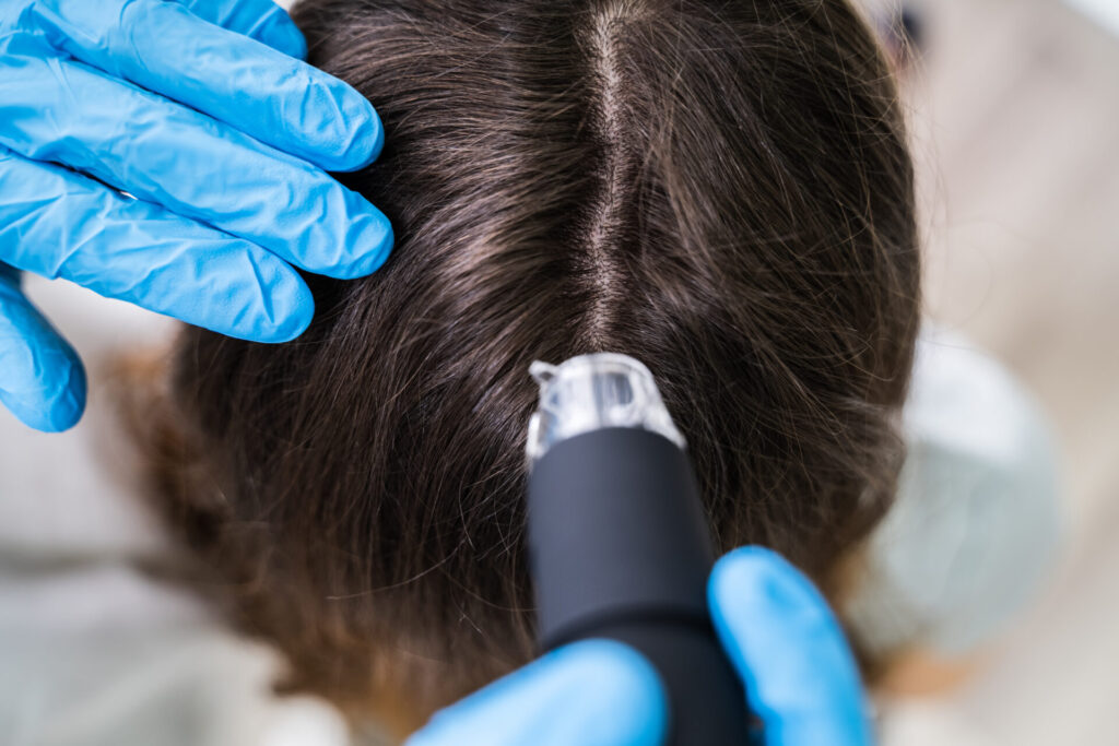 Dermatologist Using Trichoscope For Hair Fall Treatment › 스타일리쉬 플레이스 전문가가 스캐너 장비로 여성의 두피 상태를 검사하며 맞춤형 두피 마사지 방법을 제안하는 모습