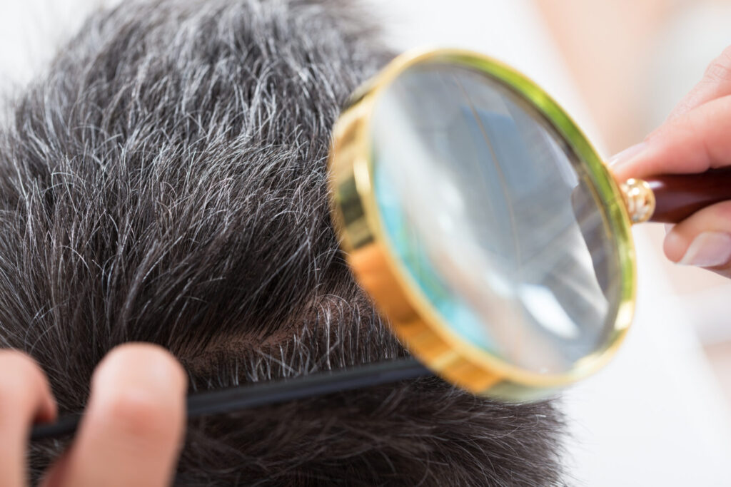 Dermatologist Checking Patients Hair › 스타일리쉬 플레이스 돋보기를 이용해 두피와 모발 상태를 세밀하게 확인하는 모습, 민감 두피 진단 이미지