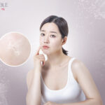 건조주의보 시즌 각질로 거칠어진 피부를 고민하는 여성 — 실내 습도 관리와 피부 보습의 중요성을 보여주는 이미지