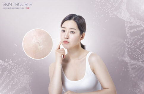 건조주의보 시즌 각질로 거칠어진 피부를 고민하는 여성 — 실내 습도 관리와 피부 보습의 중요성을 보여주는 이미지